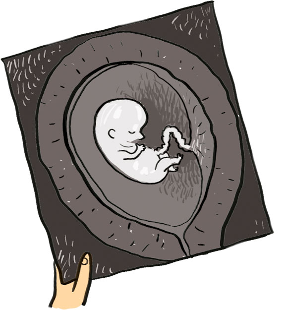 Pourquoi faut-il faire plein de prises de sang quand on est enceinte ? Astrapi, le magazine Bayard Jeunesse des 7-11 ans, répond aux questions des enfants.